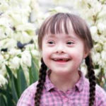 Down syndrome-adj